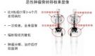 华人策略研究论坛核医学科骨检查与治疗